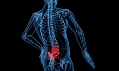 Jostas osteohondrozes attīstības iemesli