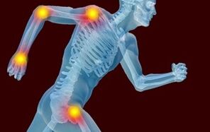 Arthrot un artrozes attīstības iemesli