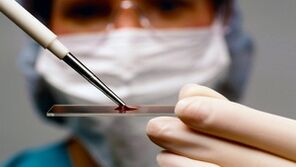 Arthrote un artrozes diagnoze