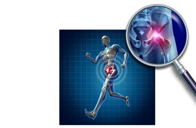 Sāpes, skrienot gūžas locītavā